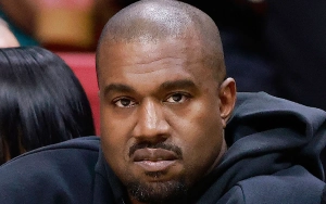 Kanye West Slammed After Flashing His $850K Titanium Dentures 