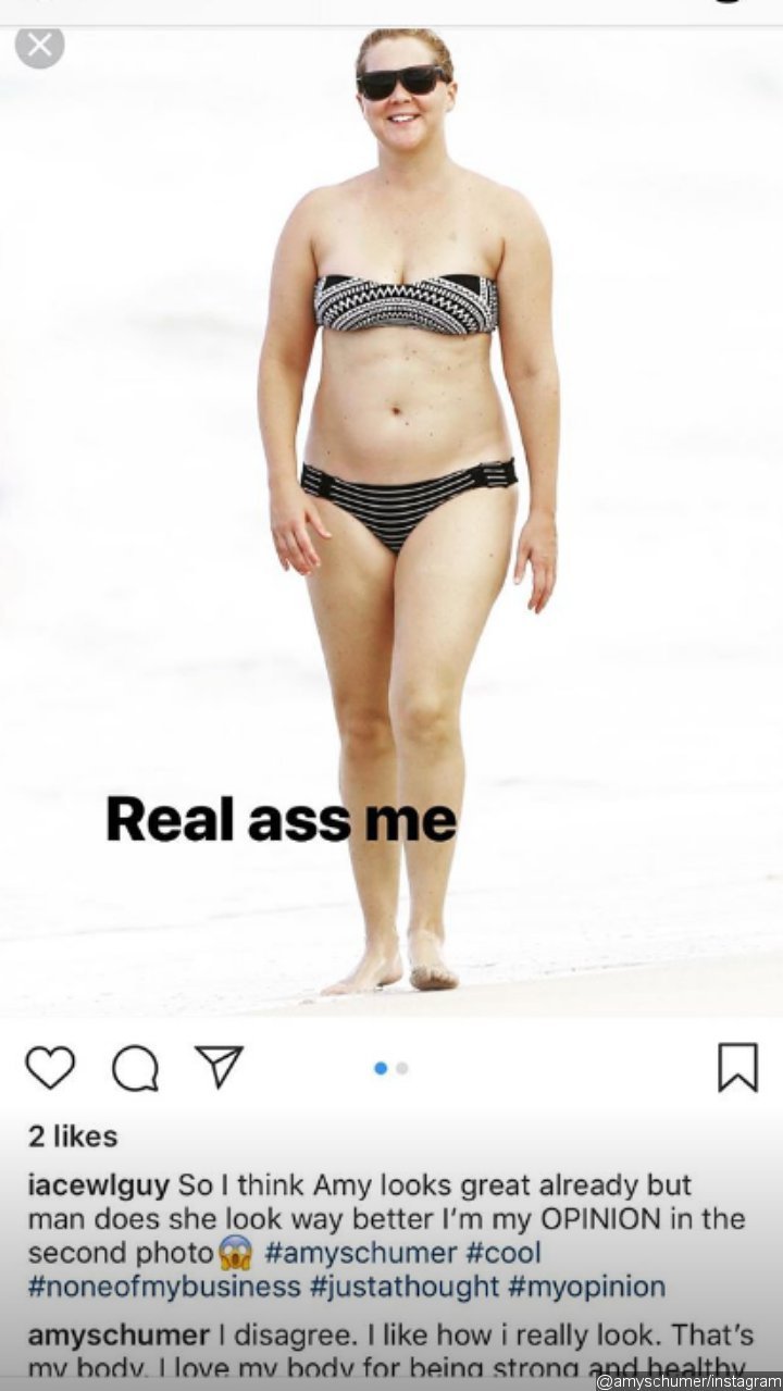 Amy Schumer's unedited bikini picture