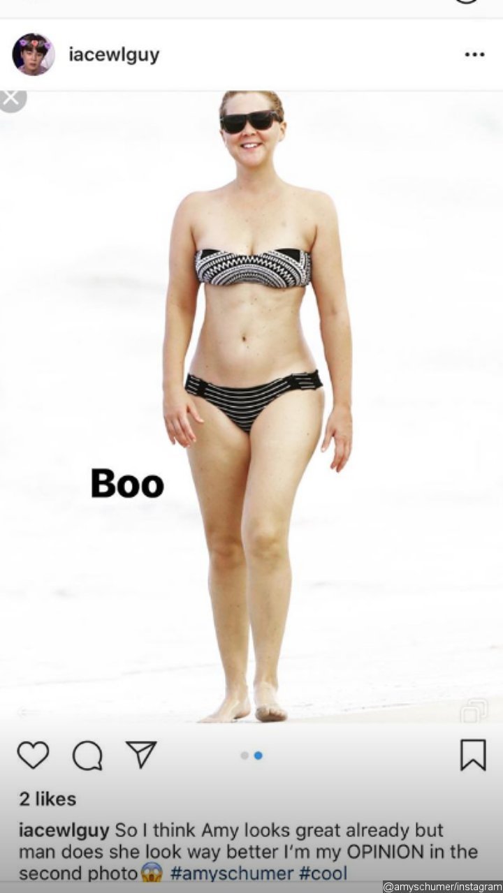 Amy Schumer's photoshopped bikini picture