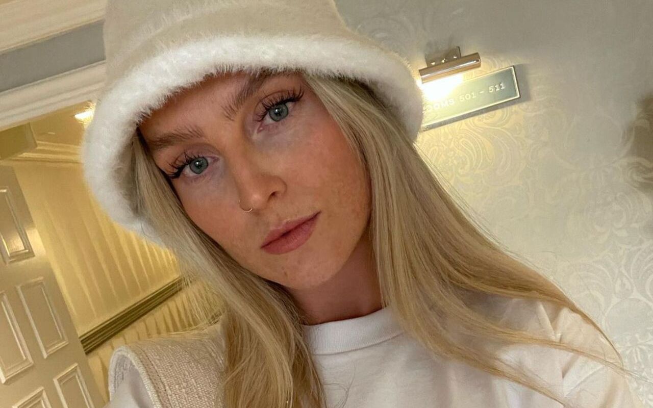 Perrie Edwards Wanted to Get Rid of Her Freckles With 'Acid Peel' When She Was Younger