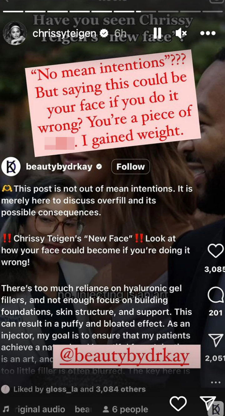 Chrissy Teigen Instagram story