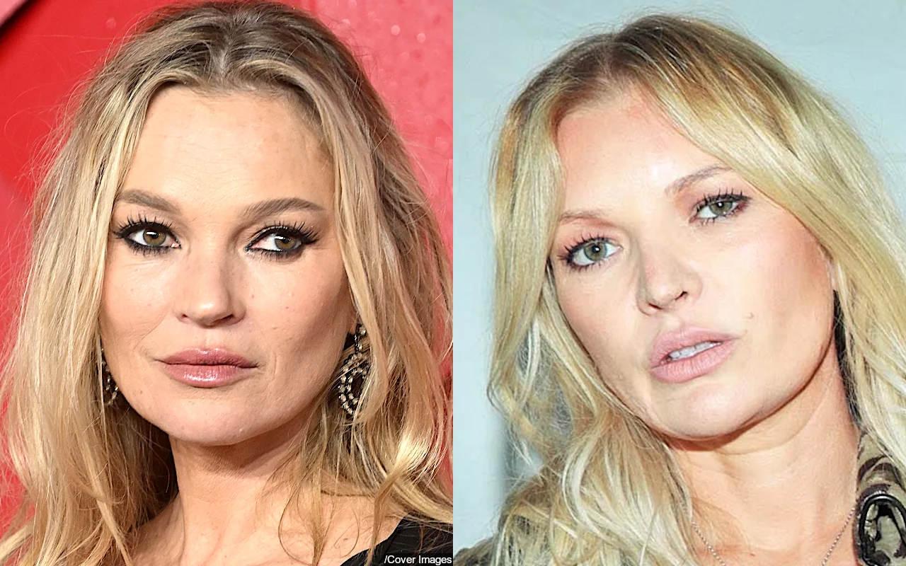 Kate Moss' Resemblance to Model Denise Ohnana Leaves Fans in Shock