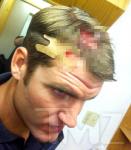 'The Avengers' Stuntman Is 'Fine' After Getting Scalped