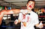Justin Bieber on Bloodied Photo Spread: You Should've Seen the Other Guy