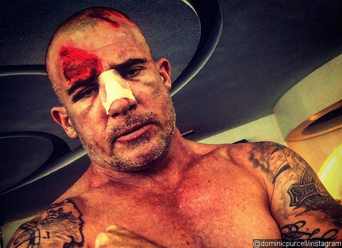 Dominic Purcell Seriously Injured on the Set of 'Prison Break'