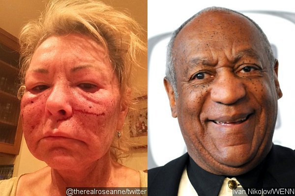 Roseanne Barr Jokes About Getting Attacked by Bill Cosby