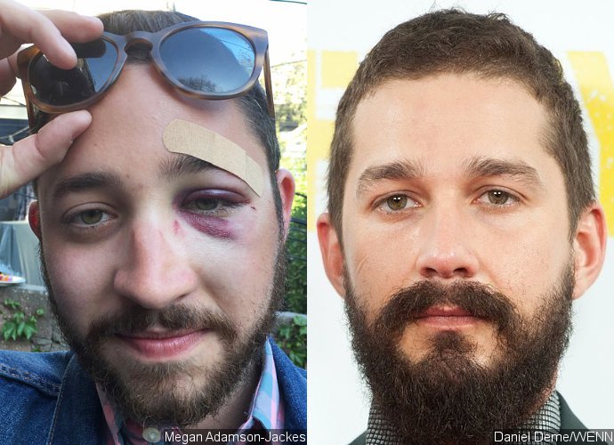 This Man Gets Punched for Looking Exactly Like Shia LaBeouf. What's His Fault?