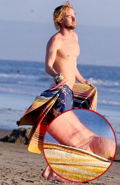 Owen Wilson Revealed His Suicide Bid Scars