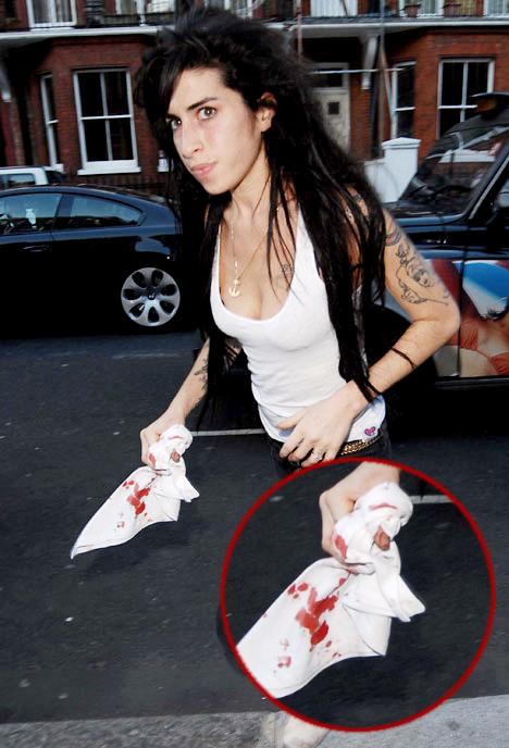 Help, Amy Winehouse Cut Herself, Again