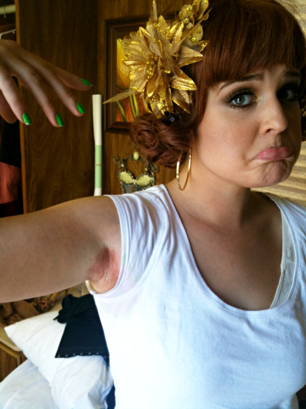 Kelly Osbourne Tweets About Having Really Bad Burns All Over Her Body