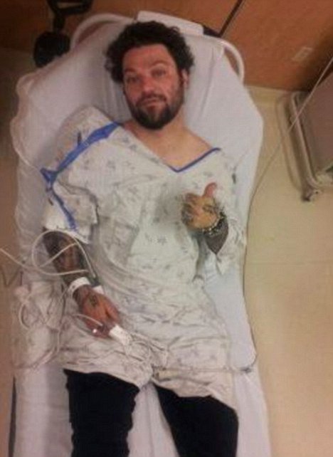'Jackass' Star Bam Margera Has 'Hernia Operation' After Doing 100-Foot Kayak Jump