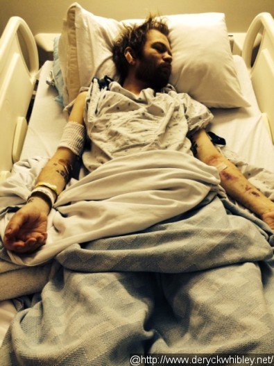 Hospitalized Deryck Whibley Says He Nearly Died Due to Alcohol Addiction