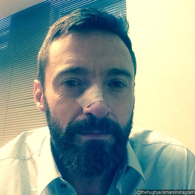 Hugh Jackman Reveals Another Skin Cancer Scare