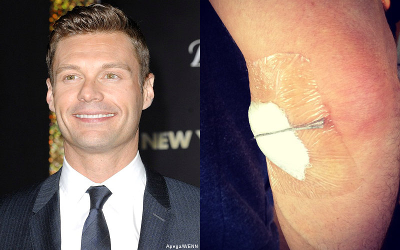 Ryan Seacrest Explains About Recent Elbow Surgery