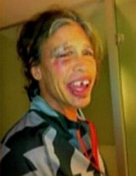 Steven Tyler Insists Bathroom Fall Has Nothing to Do With Drugs