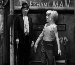 'Elephant Man' Series Slammed for Not Casting Disabled Actor