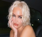 Anne-Marie Blames Phobia for Her 'Weird Relationship' With Food