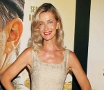 Paulina Porizkova to Undergo Hip Replacement Surgery as It's 'Worn Out'