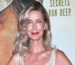 Paulina Porizkova Vows to Embrace Scars From Hip Replacement Surgery