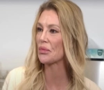 Brandi Glanville Constantly Tastes 'Oily Fowl' Drainage in Her Mouth Due to Lumps on Her Face