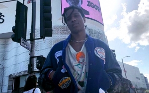 Graphic Photos Show A$AP Rocky's Alleged Victim's Injuries