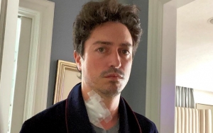 Ben Feldman Makes Use of COVID-19 Lockdown to Go Through Spine Surgery