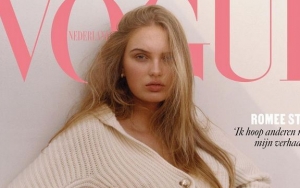 Model Romee Strijd Opens Up About Her Battle With Polycystic Ovary Syndrome