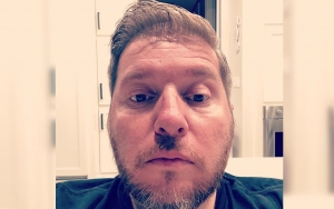 'The Little Couple' Star Bill Klein Can't Get Immediate Surgery Despite Broken Elbow