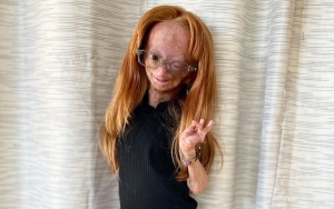 YouTube Star Adalia Rose Williams Died at Age 15 Weeks After Losing Hearing