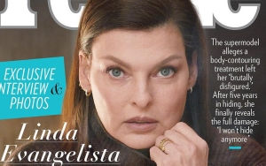 Linda Evangelista Shows Her Body for First Time After Botched Surgery Left Her 'Brutally Disfigured'