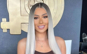 Demi Sims Gets Topless as She Proudly Bares Her Vitiligo