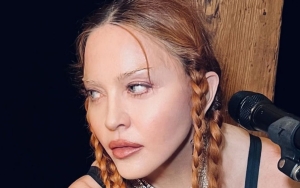 Madonna Candidly Admits to Getting Plastic Surgery After Looking Unrecognizable at Grammys