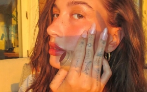 Hailey Bieber Shows Perioral Dermatitis Flare-Up on Her Face