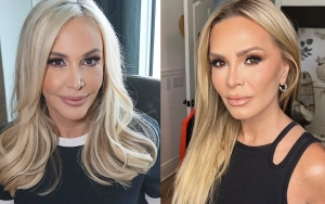 Shannon Beador Slams Tamra Judge Over DUI Commentary