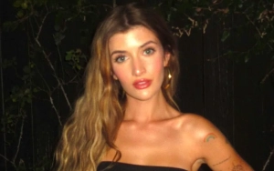 Sami Sheen Undergoes Plastic Surgery to Get Her 'Dream Nose'