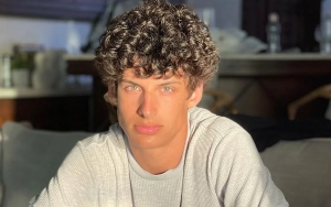 Joey Burford Requires Facial Reconstruction Surgeries After Severely Injured in Scooter Crash