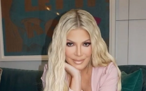 Tori Spelling Sparks Surgery Rumors With Plumped Pout