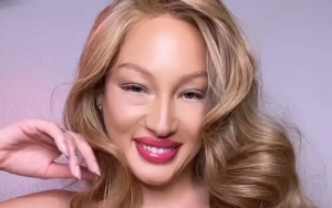 'America's Next Top Model' Alum Details Allegations of Exploitation and Emotional Distress