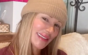 Brandi Glanville Talks About Spending All Her Money to Get Rid of Parasite From Her Face