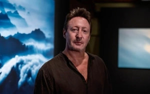 John Lennon's Son Julian Lennon Undergoes Emergency Surgery for Skin Cancer