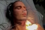 Max George Has Tough Recovery After Second Heart Surgery: 'Coughing Up Blood for Five Days'  