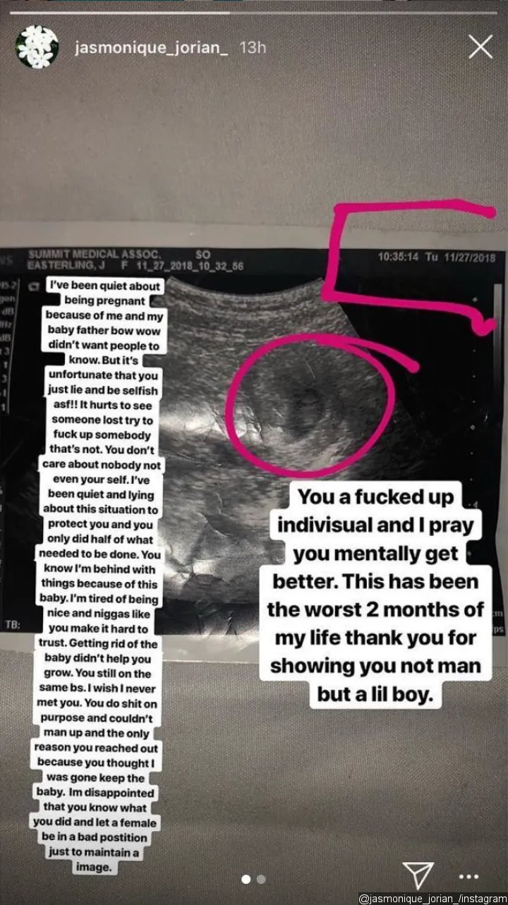 Abortion