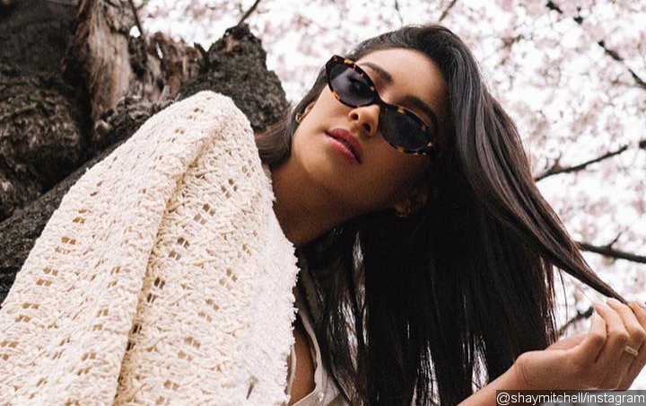 Shay Mitchell Shows Off Her 'New Look' After Losing Tooth