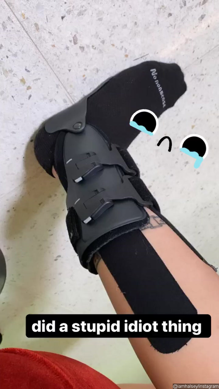 Halsey's injured leg