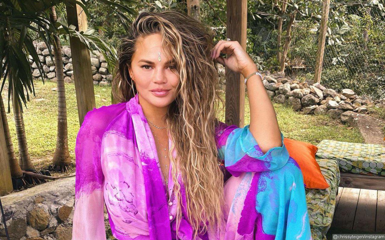 Chrissy Teigen Likens Self to 'Juicy Blow Up Doll' After Suffering From Extreme Allergic Reaction