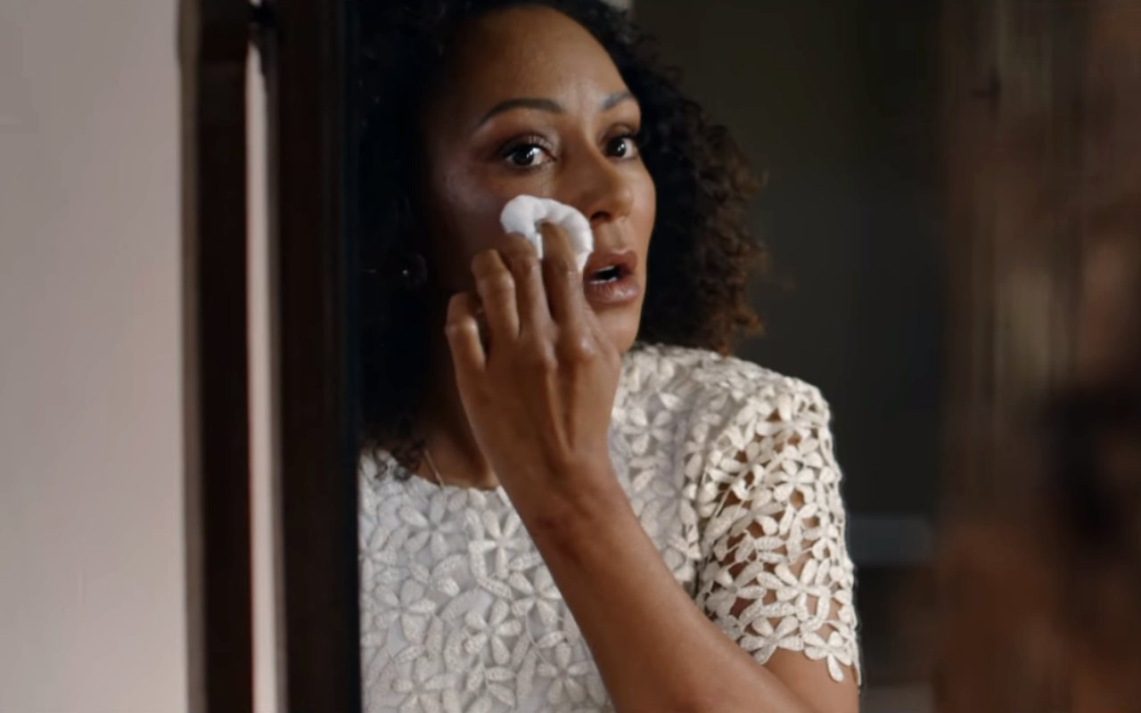 Mel B Badly Battered and Bruised in Disturbing Video Highlighting Domestic Violence