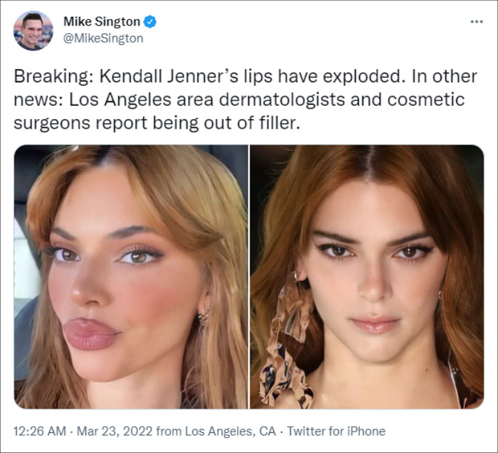 Kendall Jenner mocked over lips