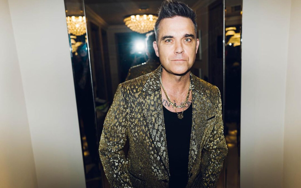 Robbie Williams Is Losing Hair and 'Embracing' It