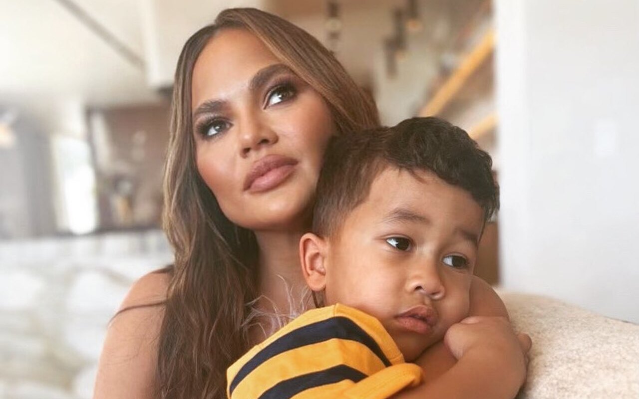 Chrissy Teigen's Son Needs Stitches on His Forehead After Getting Injured in Accident
