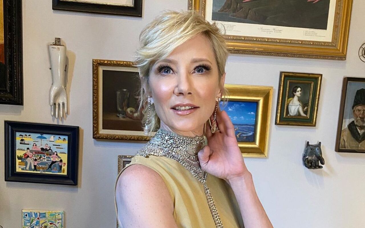 Anne Heche's Estate Sued by Her Ex Over Alleged Unpaid Loan